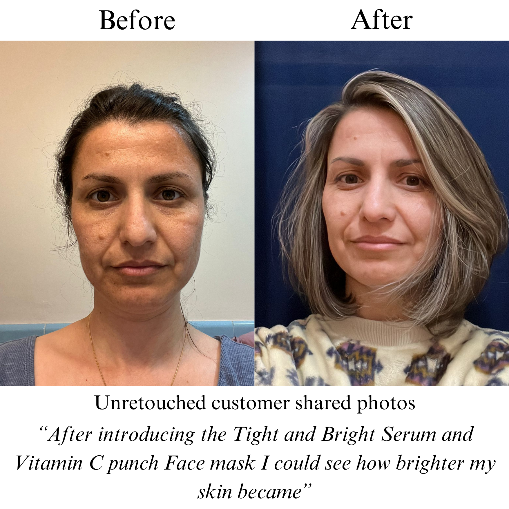 Tight & Bright – Phyto-Retinol & Vitamin C Anti-Aging Face Serum