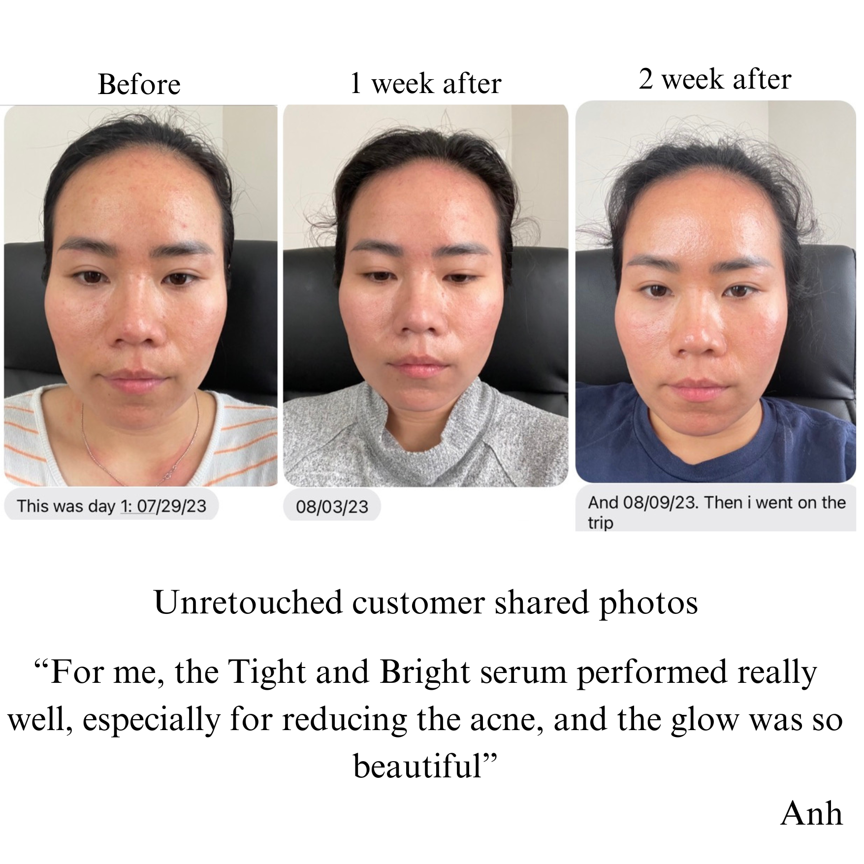 Tight & Bright – Phyto-Retinol & Vitamin C Anti-Aging Face Serum