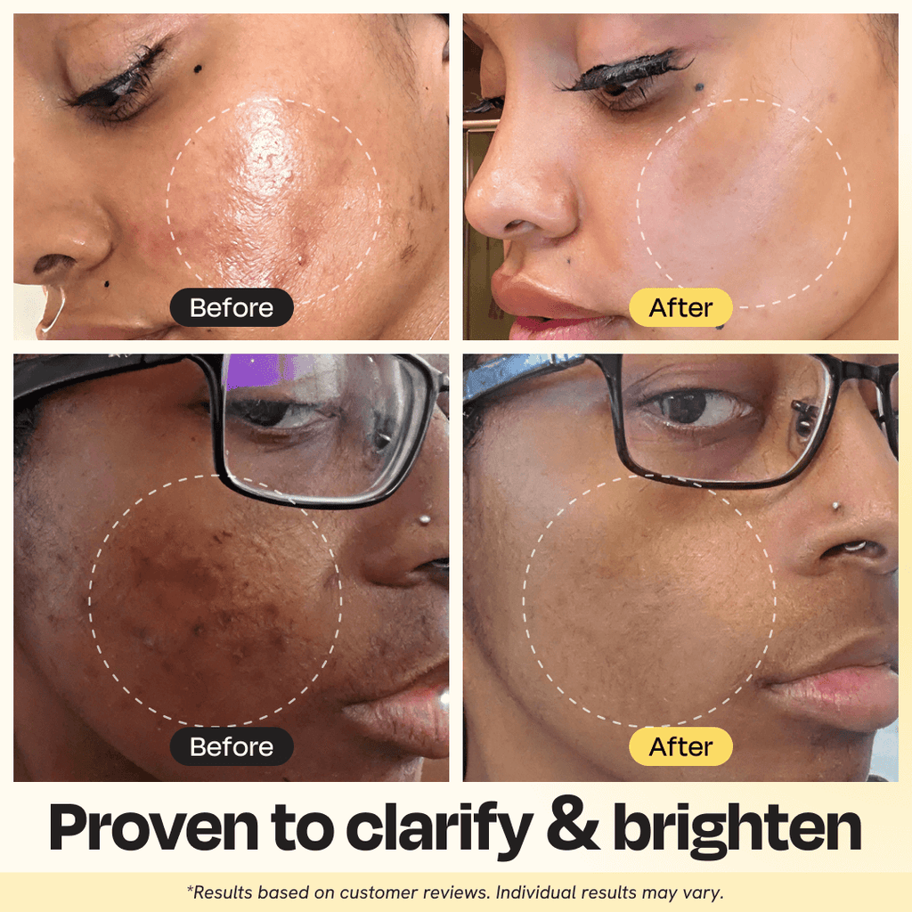 Blyss Helio – Professional-Grade LED Photon Therapy Mask