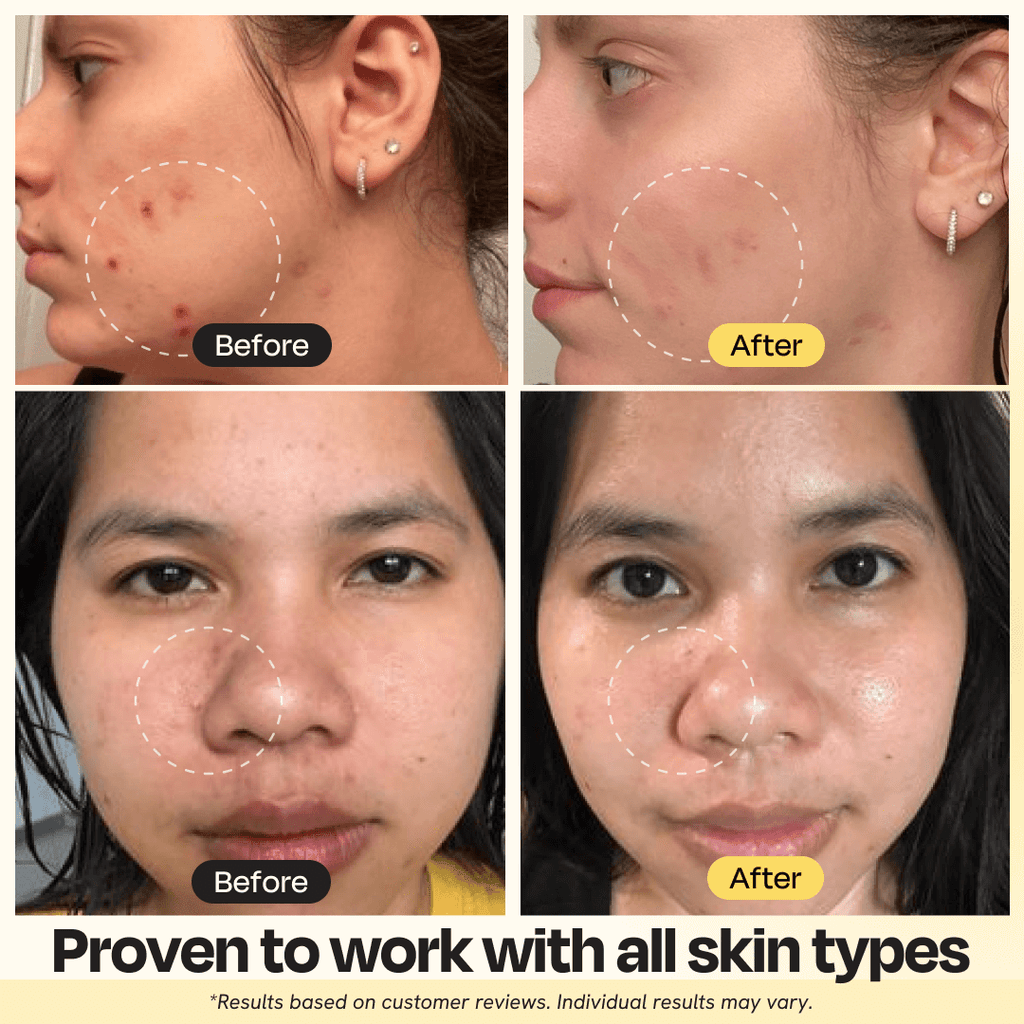 Blyss Helio – Professional-Grade LED Photon Therapy Mask