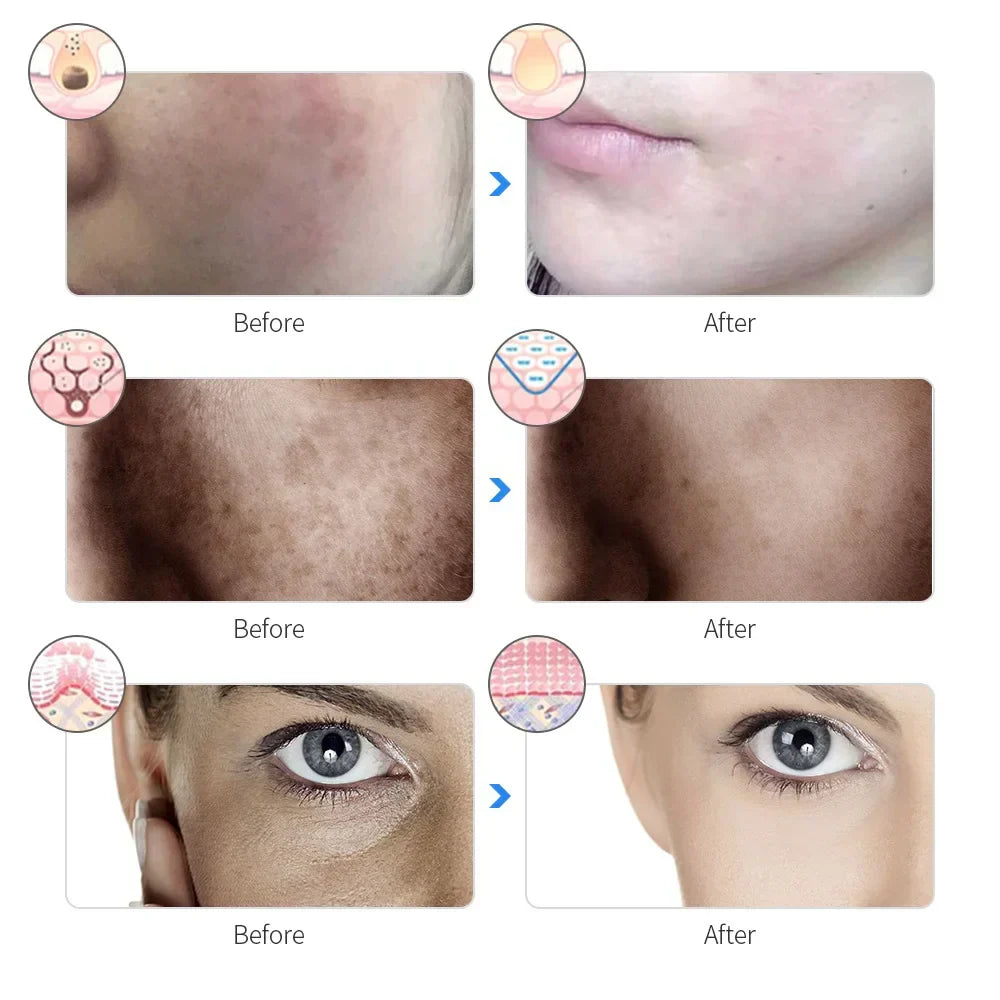 Pursonic 7-in-1 LED Light Therapy Face Mask – Rejuvenate, Restore & Reveal Your Glow