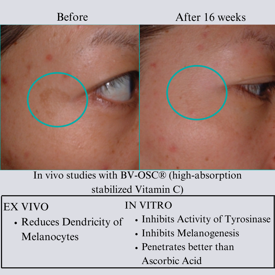 Tight & Bright – Phyto-Retinol & Vitamin C Anti-Aging Face Serum