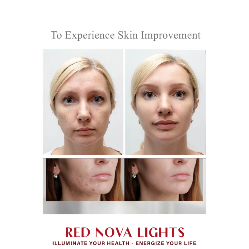 Red Light Therapy Face mask